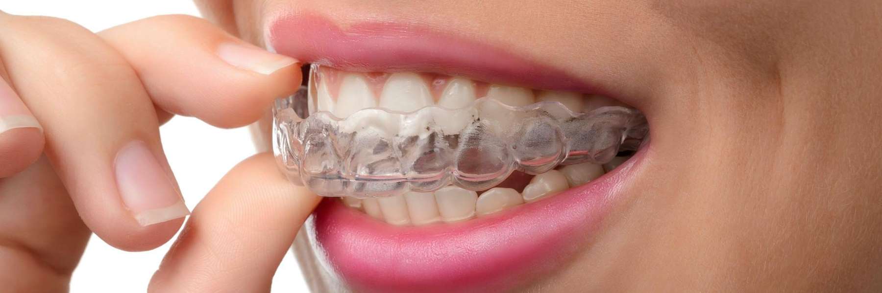 close up of kalamazoo woman using clear aligners