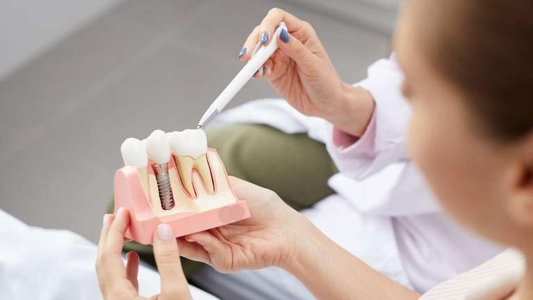 person holding dental implant mold