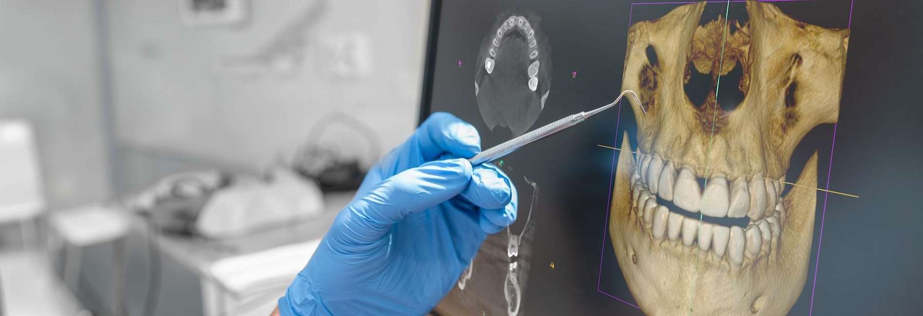 dentist pointing to dental xray
