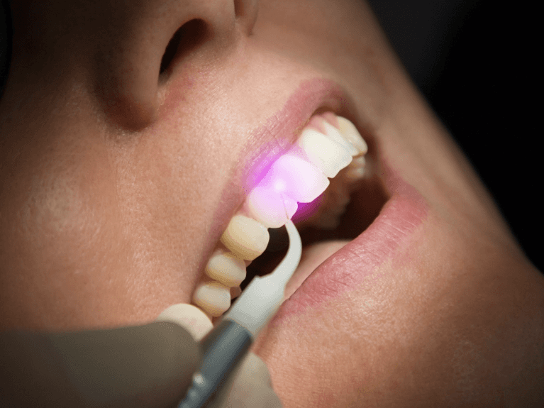 patient getting laser dentistry at kalamazoo office